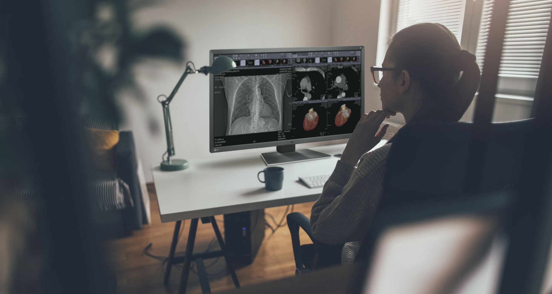 Choosing the Ideal Monitor for Teleradiology